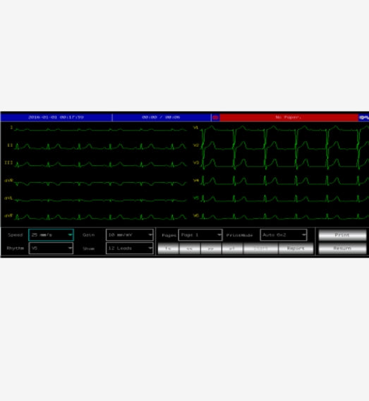 ECG 6 Pistes Contec