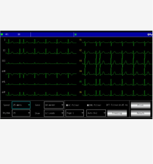 ECG 6 Pistes Contec